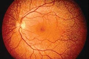 Software para diagnosticar enfermedades a travÃ©s de la retina